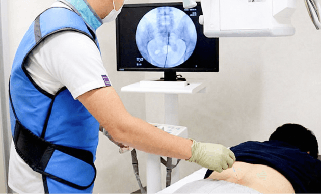 神経ブロック注射